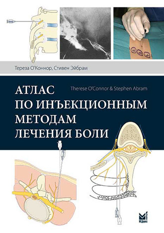 Атлас по инъекционным методам лечения боли. 2-е издание. О’Коннор Т.К. &quot;МЕДпресс-информ&quot;. 2019