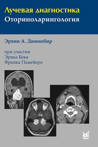 Лучевая диагностика. Оториноларингология. 3-е издание. Эрвин А. Дюннебир. &quot;МЕДпресс-информ&quot;. 2022